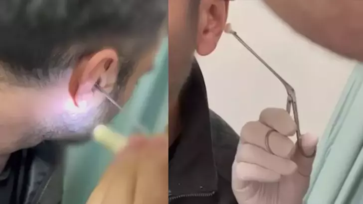 Kulağının içine yasaklı madde saklayan şüpheli yakalandı