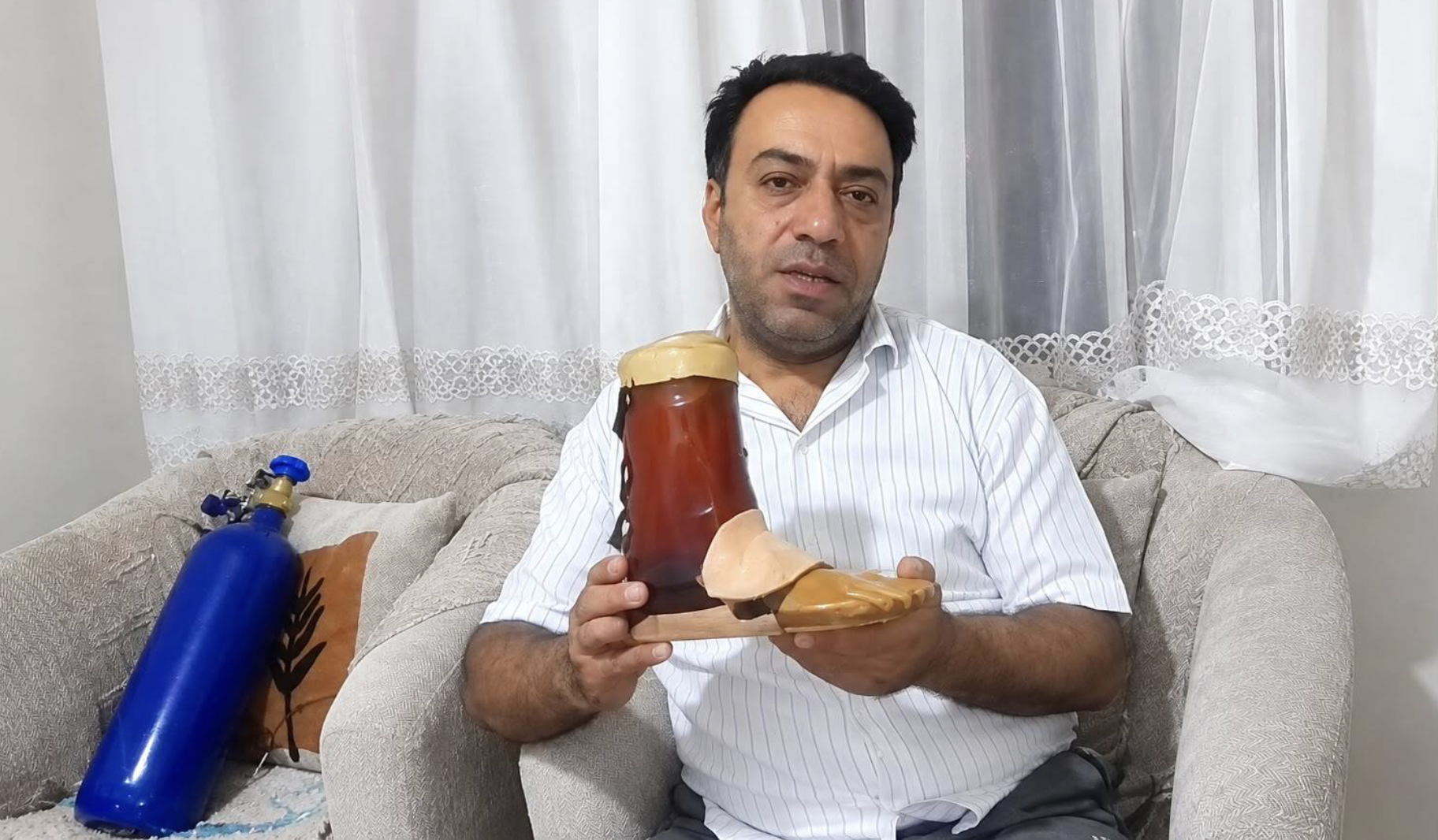 60 bin liralık protezini koli bandıyla tamir ediyor!