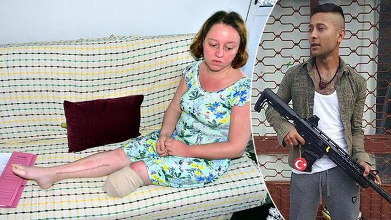 Eşini vurup bacağının kesilmesine neden olan eşe indirimsiz ceza