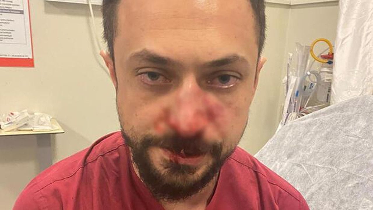 Şanlıurfa'da hasta yakınından doktora saldırı! Benim hastam daha acil dedi, doktorun burnunu kırdı