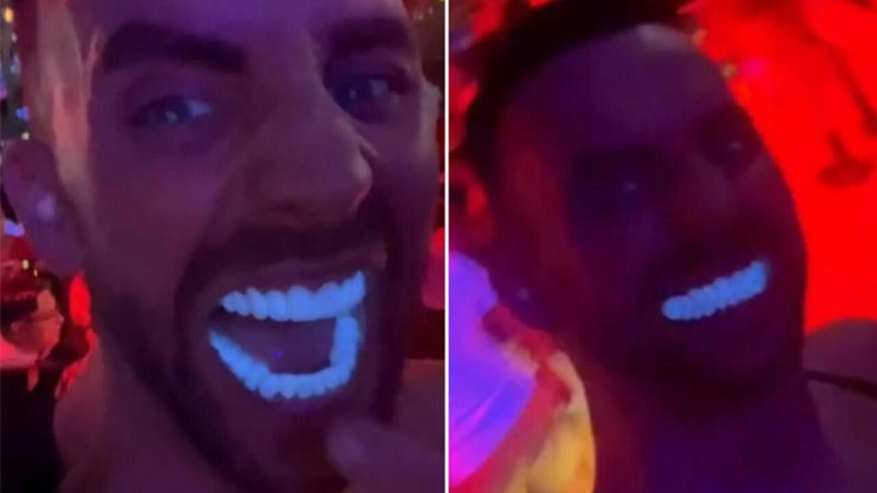 Türkiye'de yaptırdığı dişlerle gece kulübüne giden adam viral oldu