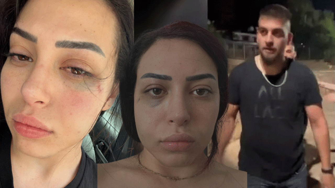 Türk kızına Kıbrıs Rum Kesimi'nde korkunç saldırı