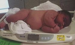Dünyanın en ağır bebeği tarihe geçti! Kilosuyla herkesi şaşırttı
