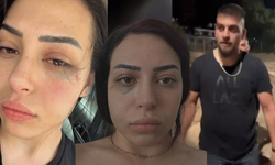 Türk kızına Kıbrıs Rum Kesimi'nde korkunç saldırı