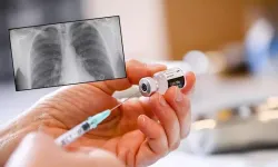Adı bile belli oldu! Yeni aşı akciğer kanserine karşı umut oldu