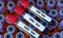 İngiltere'de H1N2 grip türü ilk kez insanda görüldü