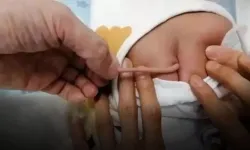 Kuyrukla dünyaya gelen bebek şoke etti! Doktorlar nedenini açıkladı