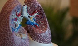 Akciğer kanserine karşı yeni umut: ′İhtimal vermediğimiz hastalar iyileşiyor′