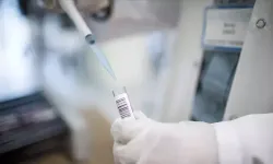 Maymun çiçeği virüsü Afrika kıtasının dışına sıçradı!