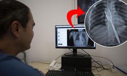 Aydın'da sıra dışı vaka! Doktorlar bile inanamadı, röntgende gerçek ortaya çıktı