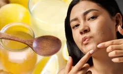 Yağlı ve Sivilceli Cilt Sorununa Son! Limonlu Maske Kremlerden 10 Kat Etkili