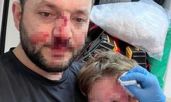 Komşuların gürültü kavgasında 14 aylık bebek hastanelik oldu