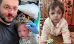 14 aylık bebeğin yaralandığı olayda pes dedirten savunma