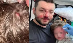 Kucağında bebeği ile darbedilen babanın oğlu, sokakta başına atılan taşla yaralandı