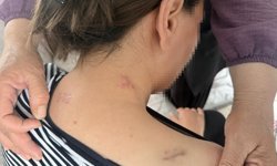 17 bıçak darbesi aldı, ölü numarasıyla kurtuldu