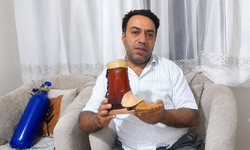 60 bin liralık protezini koli bandıyla tamir ediyor!
