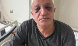 İZMİR’DE ESNAF ODASI BAŞKANINA SİLAHLI VE BIÇAKLI SALDIRI: 1 GÖZALTI