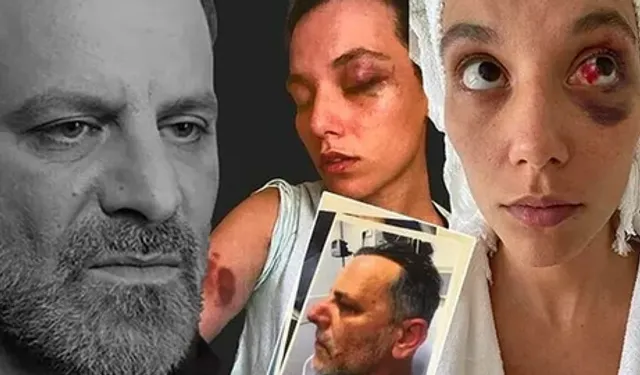 Ozan Güven'in 'kadına şiddet' davası: 'Yaralanma hafif nitelikte değil'