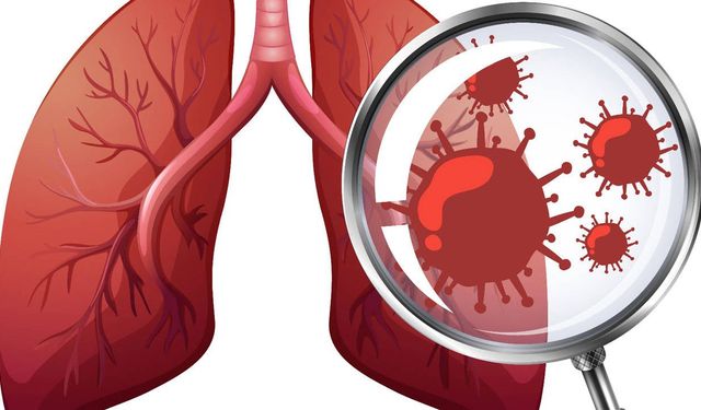 Korkutan tablo: Akciğer kanseri her yıl 1,5 milyon can alıyor