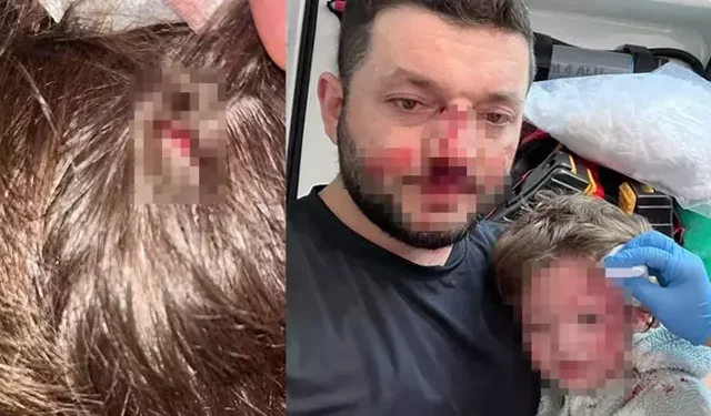 Kucağında bebeği ile darbedilen babanın oğlu, sokakta başına atılan taşla yaralandı