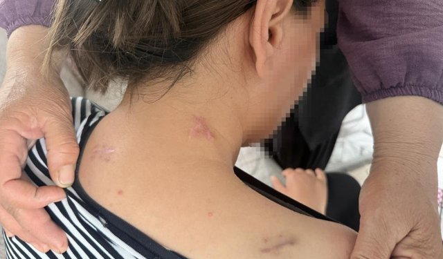 17 bıçak darbesi aldı, ölü numarasıyla kurtuldu