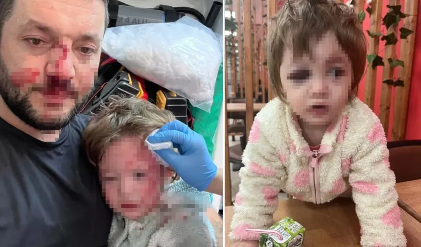 14 aylık bebeğin yaralandığı olayda pes dedirten savunma