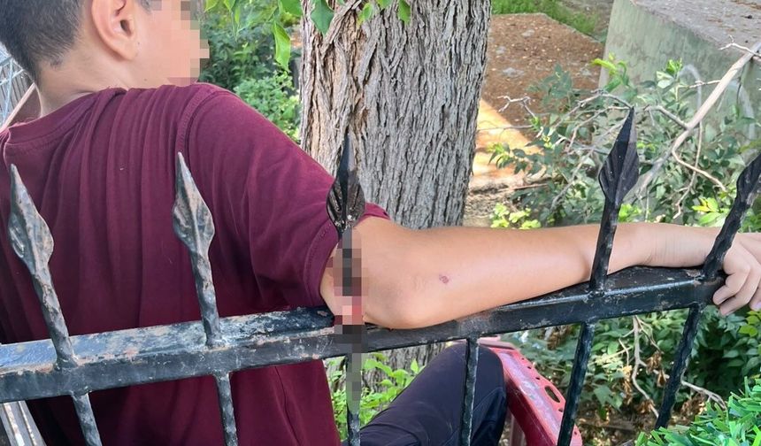 Demir korkuluk öğrencinin koluna saplandı, itfaiye kurtardı