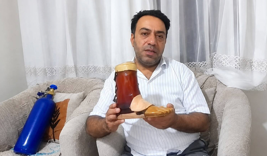 60 bin liralık protezini koli bandıyla tamir ediyor!